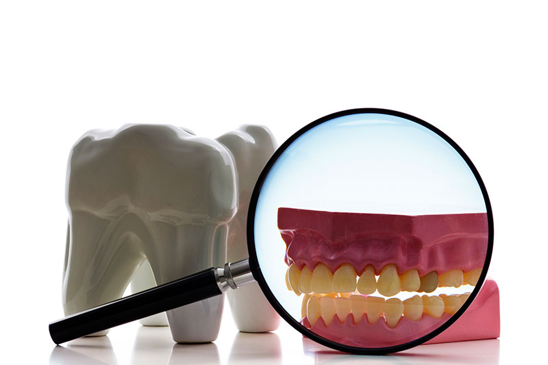 Root Canals in South San Francisco